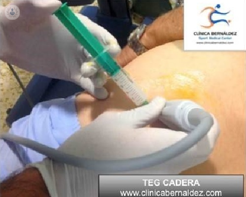 TEG (Terapia Ecoguiada),  lo último en el tratamiento de lesiones de partes blandas