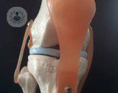 asi-funciona-la-cirugia-de-artrosis-de-rodilla