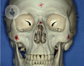 traumatismo-facial
