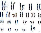 mapa-genetico-cromosomas
