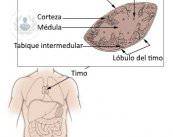 timo-en-infecciones-y-hematologia