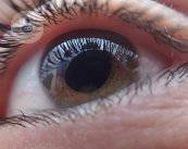 glaucoma-hipertension-ocular