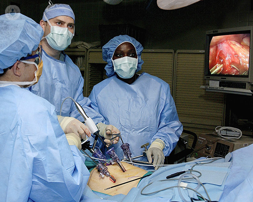 cirugia-laparoscopica-cancer-esofago-tecnica-doctores