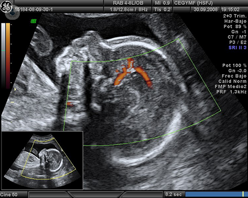 ecografia-doppler-control-fetal-embarazo