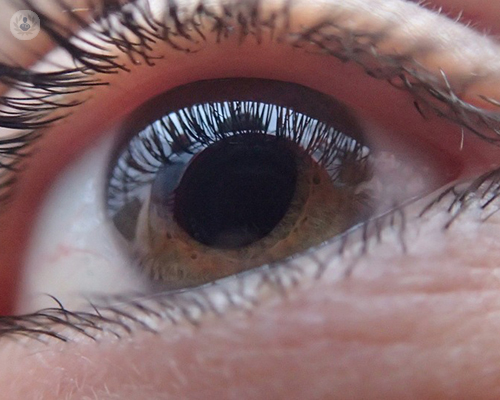ojo-vision-vista-hipertension-ocular-glaucoma