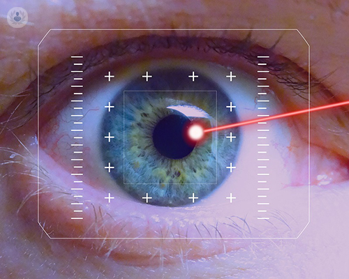cirugia-laser