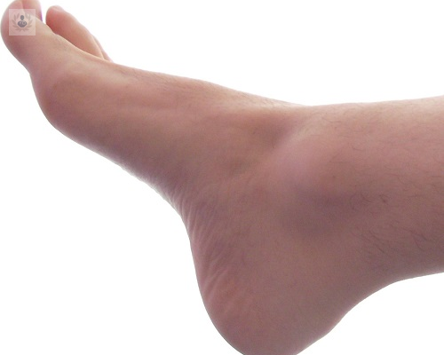 Cirugía percutánea del pie con menores complicaciones