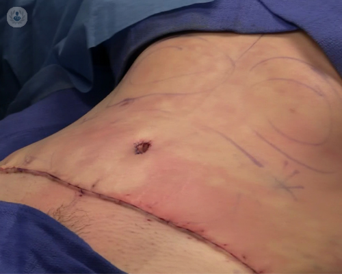 abdominales-mujer