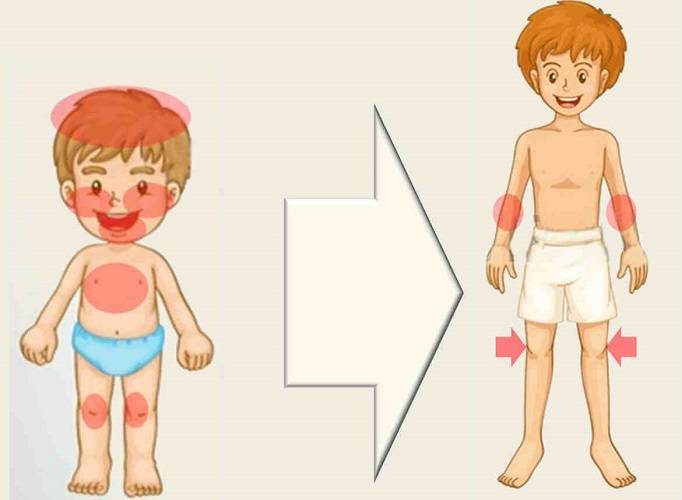 consecuencias-de-la-dermatitis-atopica imágen de artículo