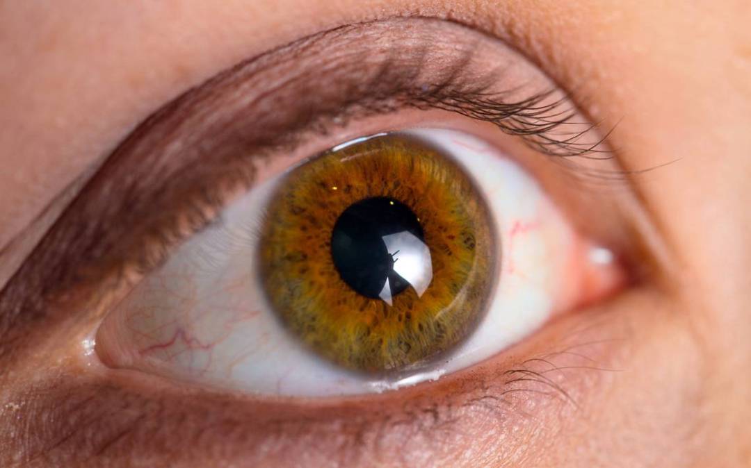 Día Mundial del Glaucoma