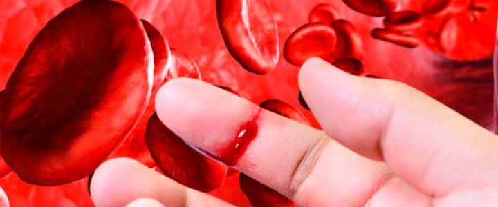 signos-de-alerta-de-la-hemofilia imágen de artículo