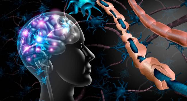 esclerosis-multiple-una-enfermedad-que-no-es-hereditaria-ni-mortal imágen de artículo