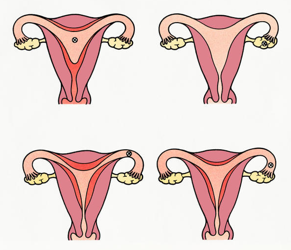 ciclo-menstrual-que-es-y-cual-es-su-duracion imágen de artículo