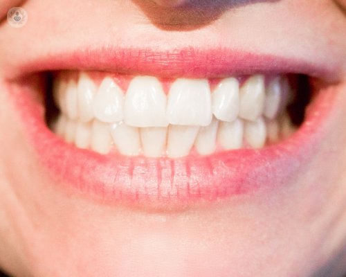 sonrisa-perfecta-mujer