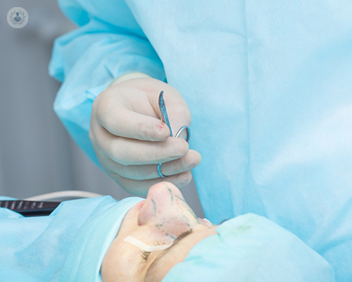 cirugia-rinoplastia