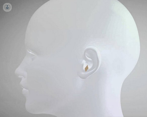 earfold