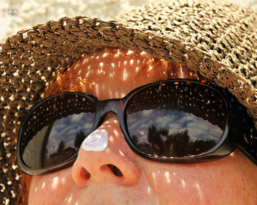 melanoma