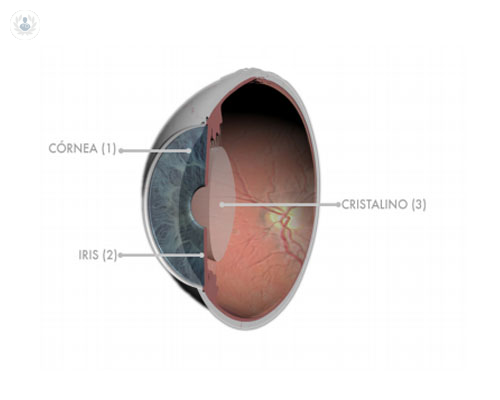 cataratas-perdida-de-transparencia-ojo