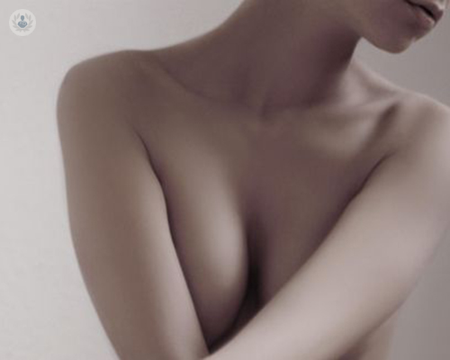 mastopexia-para-la-elevacion-de-mamas