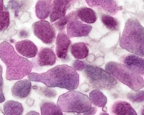 mycoplasma-genitalium-complicaciones