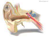 la-otitis