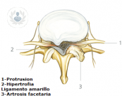 imagen-columna