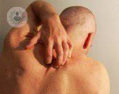 picor-con-urticaria
