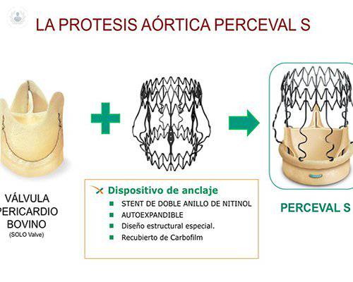 valvula-aortica-2