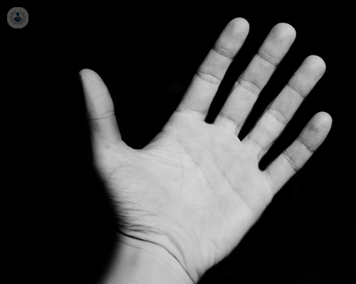 fractura-de-mano