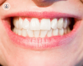 sonrisa
