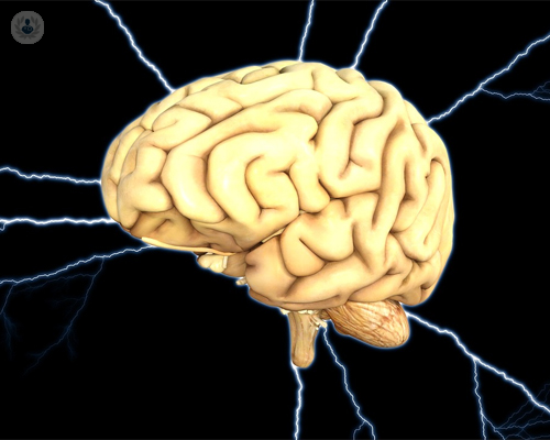 estimulacion-cerebral-profunda