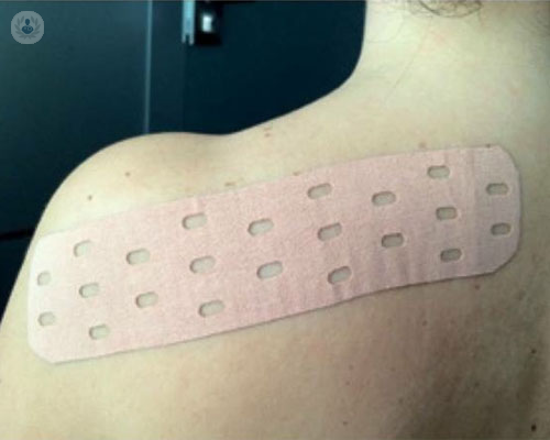 linfedema-punch-tape