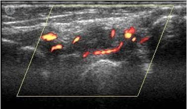 ecografia musculoesqueletica