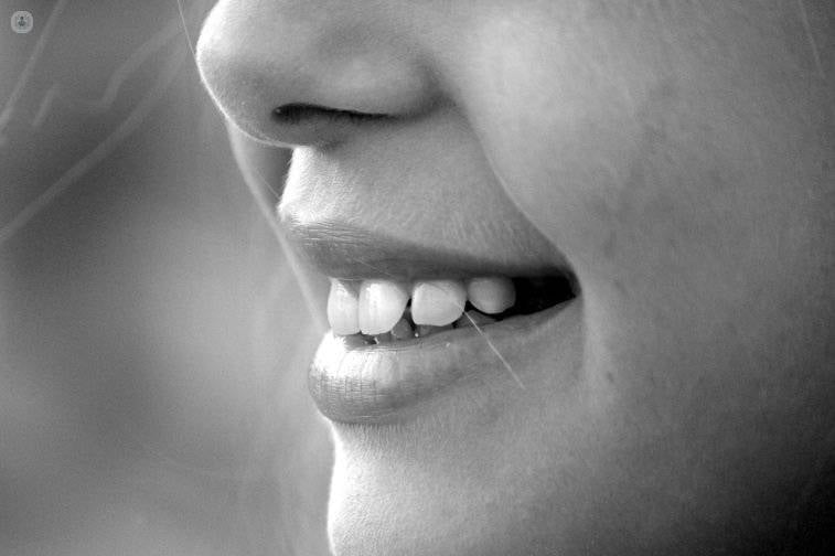 Dientes de leche