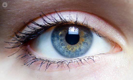 IPL ojo laser