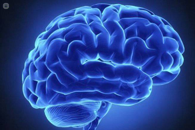 tratamiento endovascular cerebro