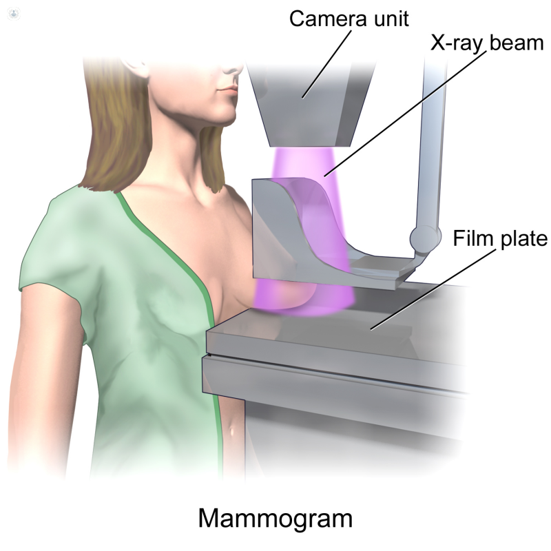 dibujo mamografia