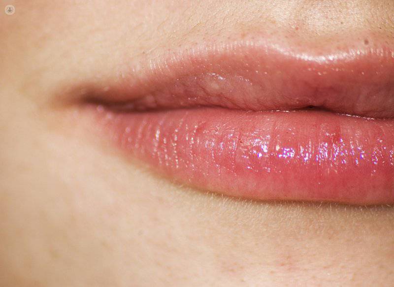 Aumento De Labios ¿qué Técnicas Existen Top Doctors