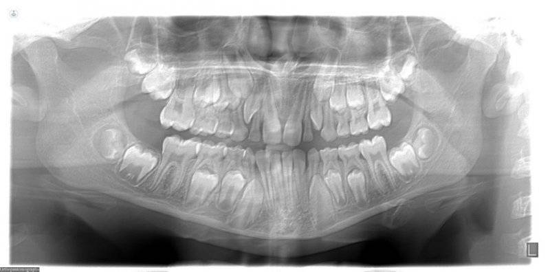 ortopantomografia dental