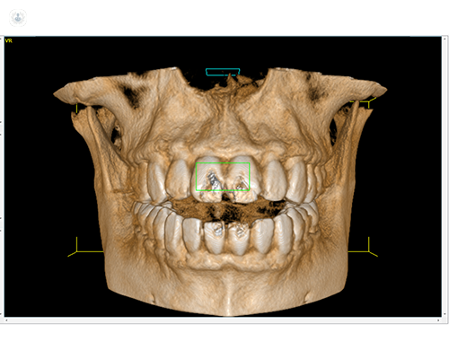 imagen 3D