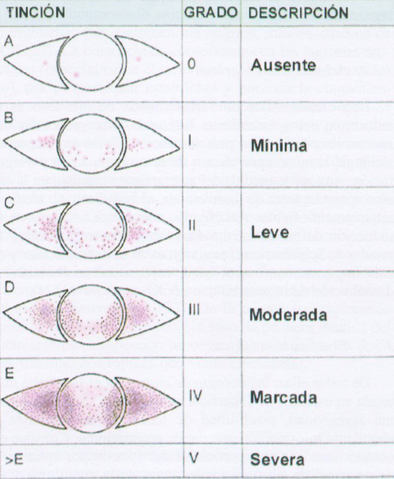 clasificación análisis rosa de bengala 