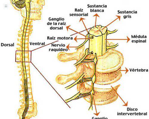 lesion de la medula