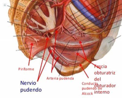 neuralgia pudenda perfil