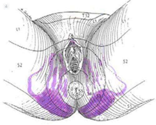 neuralgia pudenda