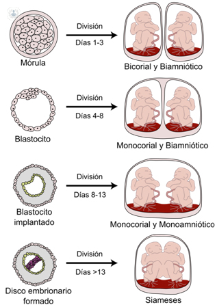 Diferencias Entre Mellizos Y Gemelos | Top Doctors