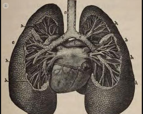 enfisema pulmonar